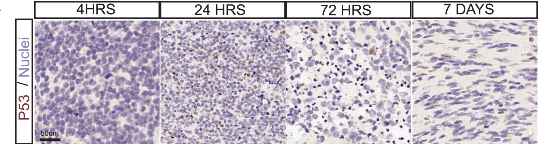 Open access visualization of Microscopy, Immunohistochemistry Images, Dopamine Neurons, Apoptosis Markers, p53