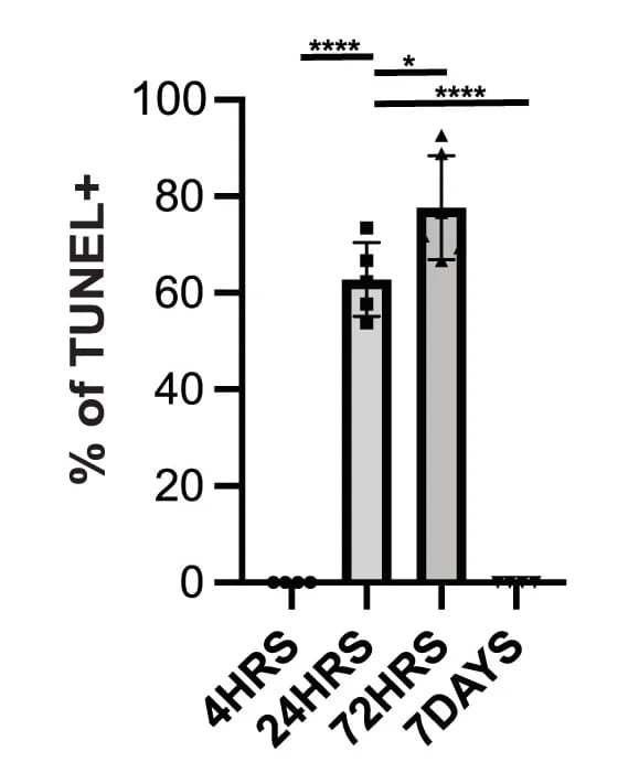 Open access visualization of Bar Plot, Error Bars, Dopamine Neurons, Apoptosis Markers, TUNEL