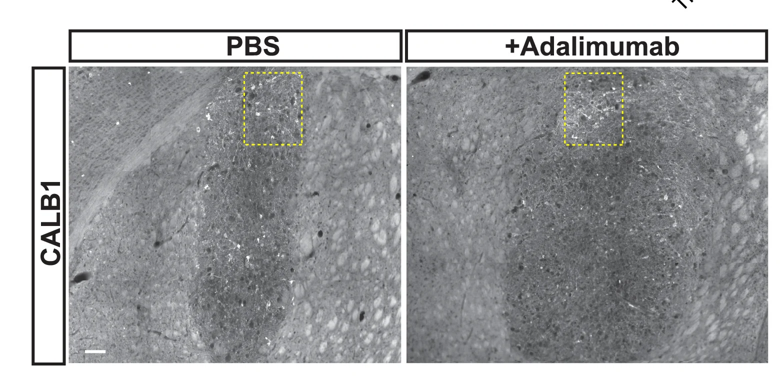 Open access visualization of Microscopy, Photo, Immunofluorescence Images, ALDH1A1+ A9 Subtype, CALB1+ A10 Subtype