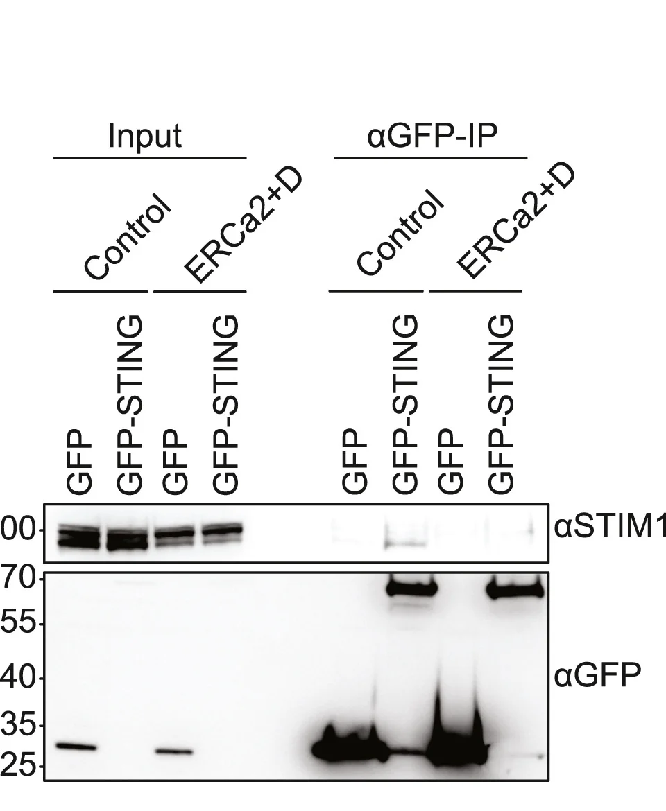 Open access visualization of Gel, Immunoprecipitation, GFP, GFP-STING, N2a Cells