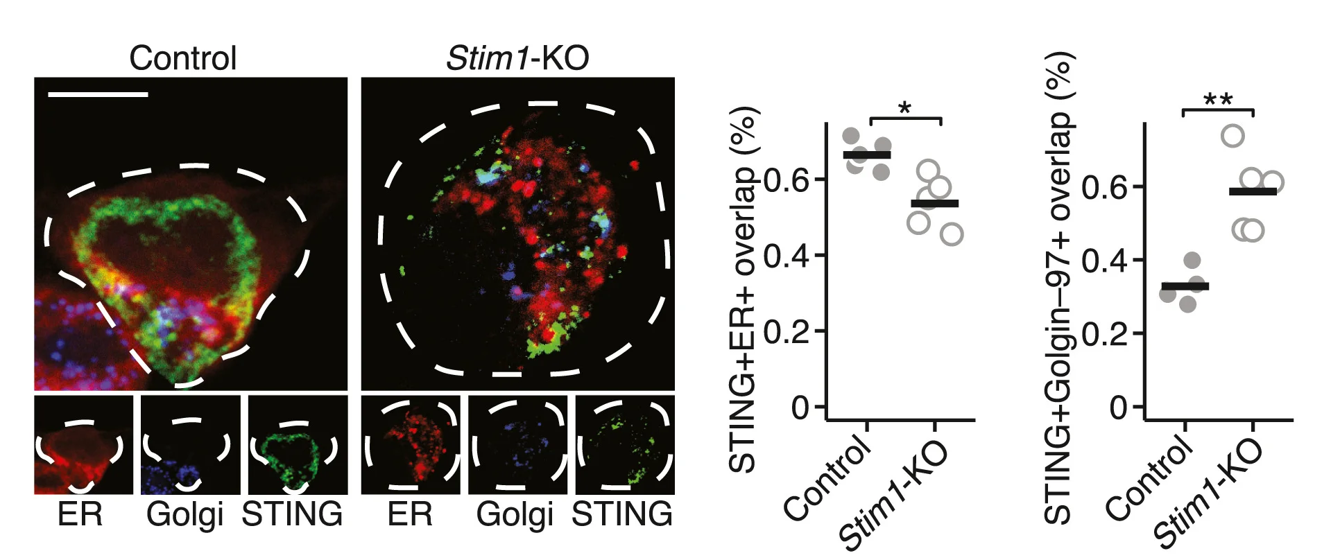 Open access visualization of Scatter Plot, Microscopy, STING+ER+, STING+Golgin-97+, WT Control