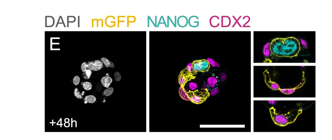 Open access visualization of Microscopy, Immunostaining, PdgfraCre-ERT2:Rosa26mT/mGembryos, Markers