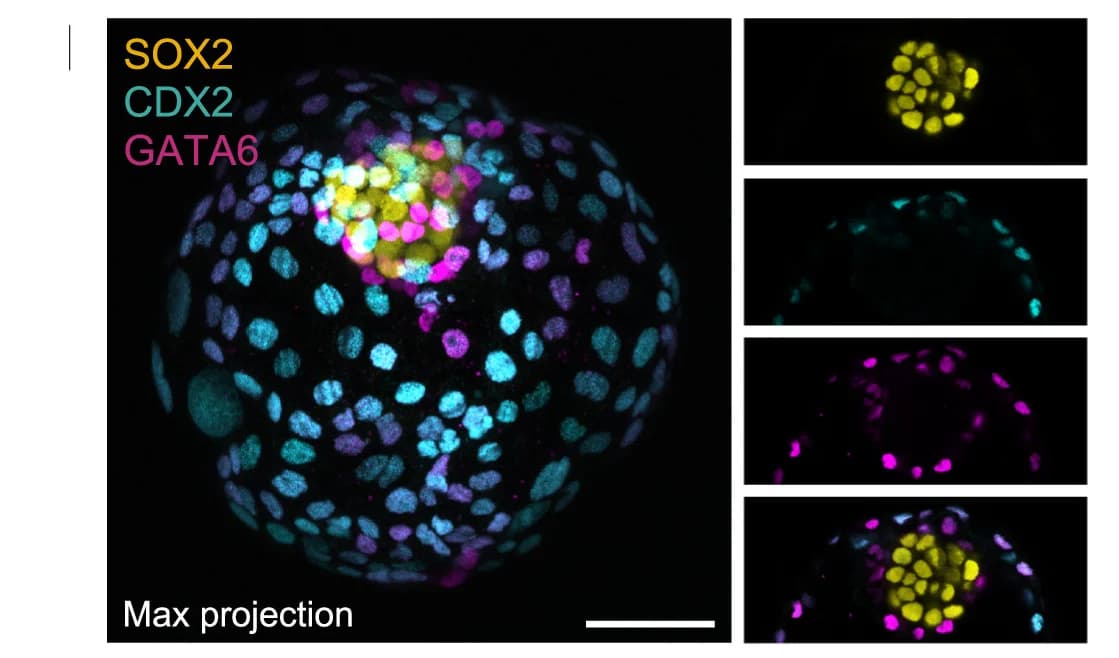 Open access visualization of Microscopy, Immunostaining, DP Cells, nEnd-derived Blastoid, Markers
