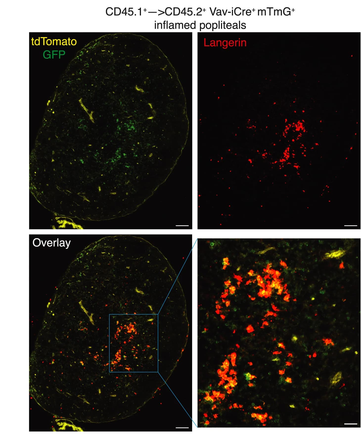 Open access visualization of Microscopy, IFM, LCMV-inflamed pLN, Chimeric Mice, Langerin