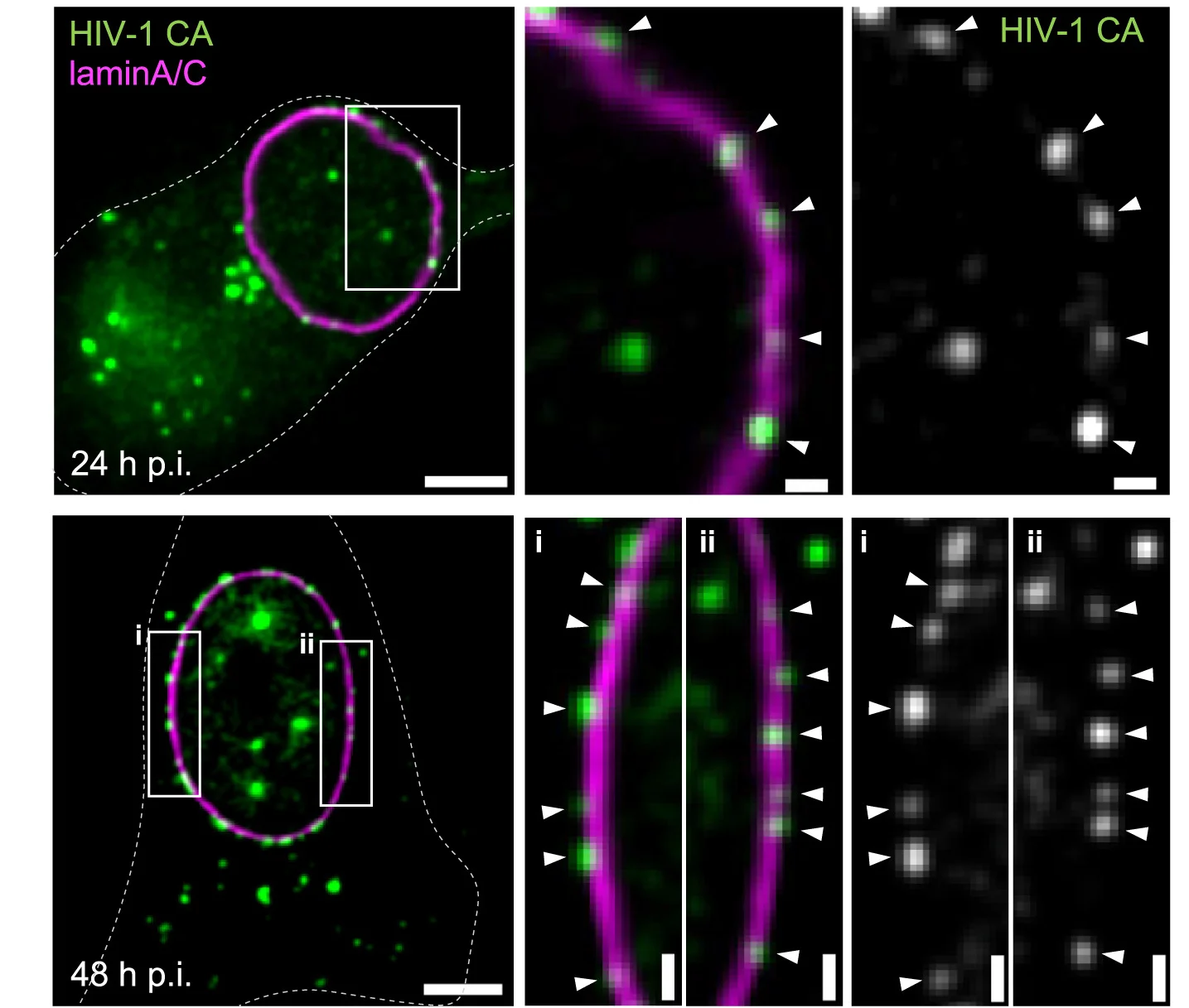 Open access visualization of Microscopy, MDMs, NNHIV, HIV-1 CA, Lamin A/C