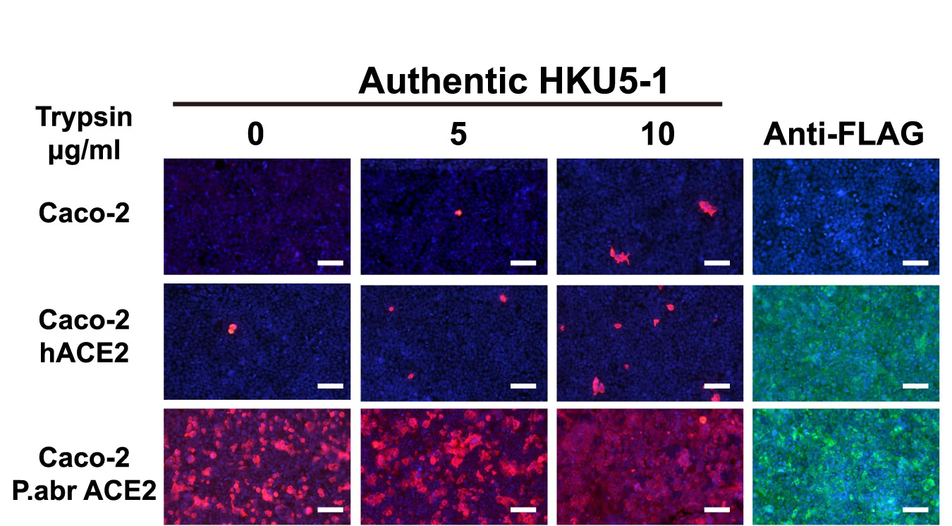 Open access visualization of Microscopy, Wild-Type Authentic HKU5-1, Caco-2 Cells, Human ACE2, P.abrACE2
