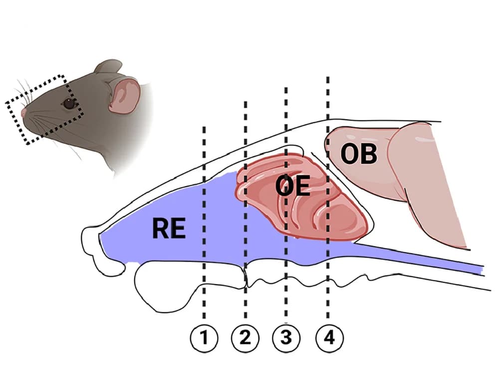 Open access visualization of Illustration, Coronal Sections, Schematic Diagram