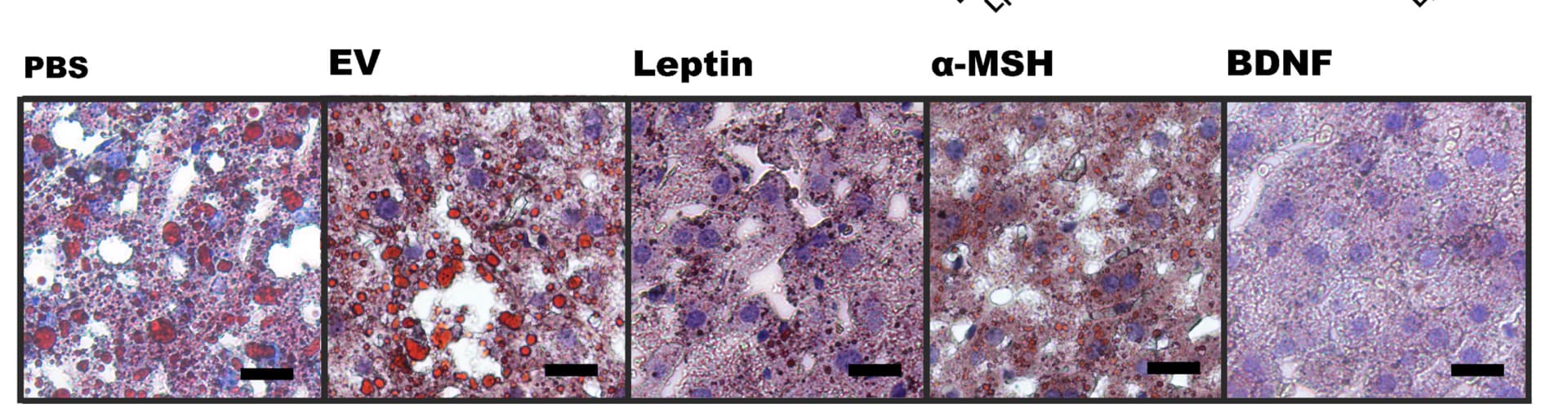 Open access visualization of Microscopy, Oil Red O Staining, Liver, Mice, Lp-EV
