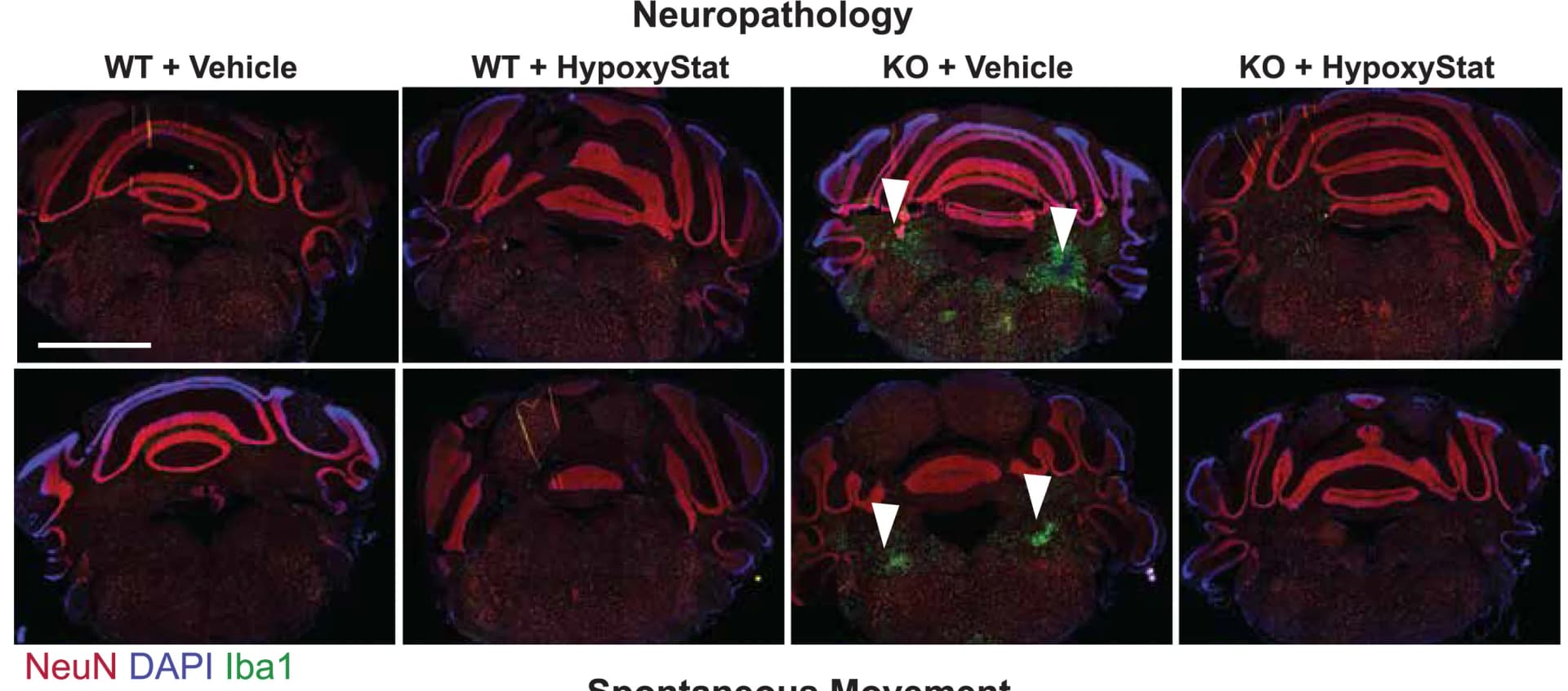 Open access visualization of Microscopy, Neuropathology Images, Iba1 Staining, WT Mice, KO Mice