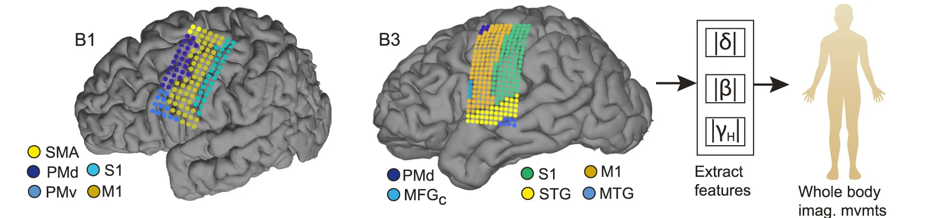 Open access visualization of Illustration, Workflow, Electrodes, Anatomical Locations, Delta
