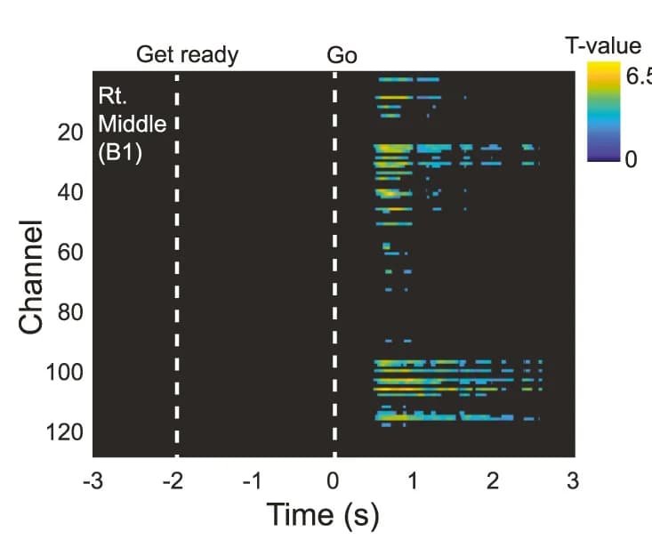 Open access visualization of Heatmap, Spatiotemporal Cluster Correction Image, HERPs, ERP, T-test