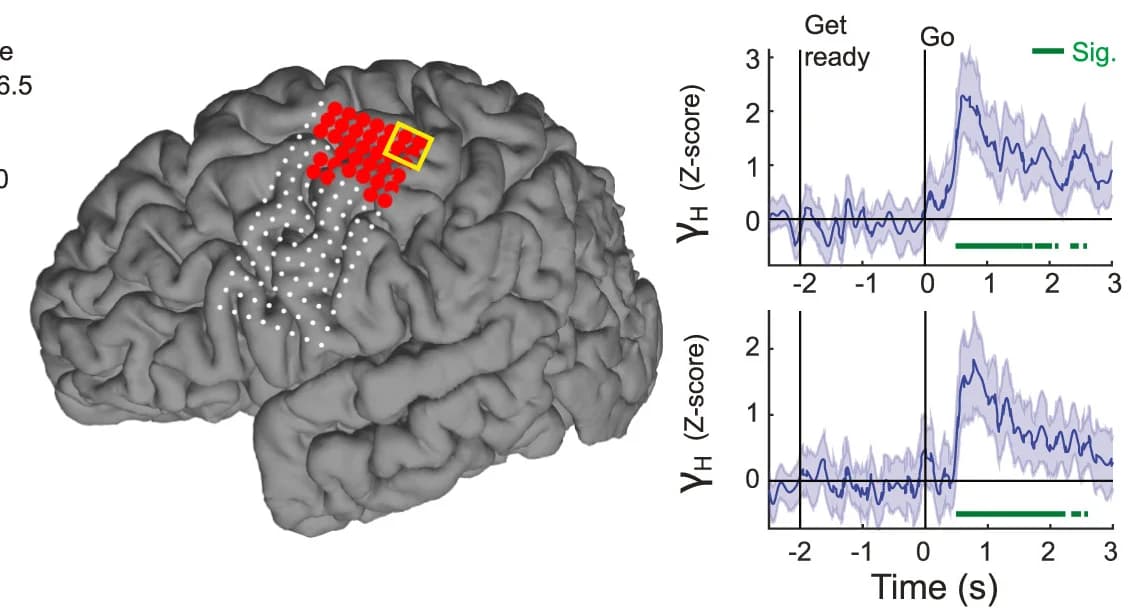 Open access visualization of Line Plot, Error Bars, 3D Plot, Significant Electrodes, Spatiotemporal HERPs