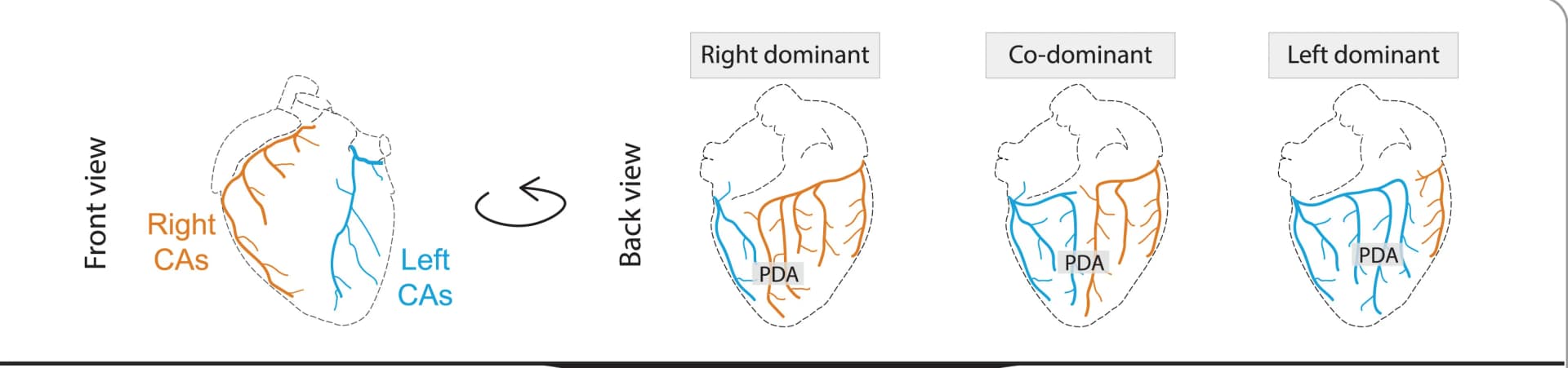 Open access visualization of Illustration, PDA, Human Heart, Dominance