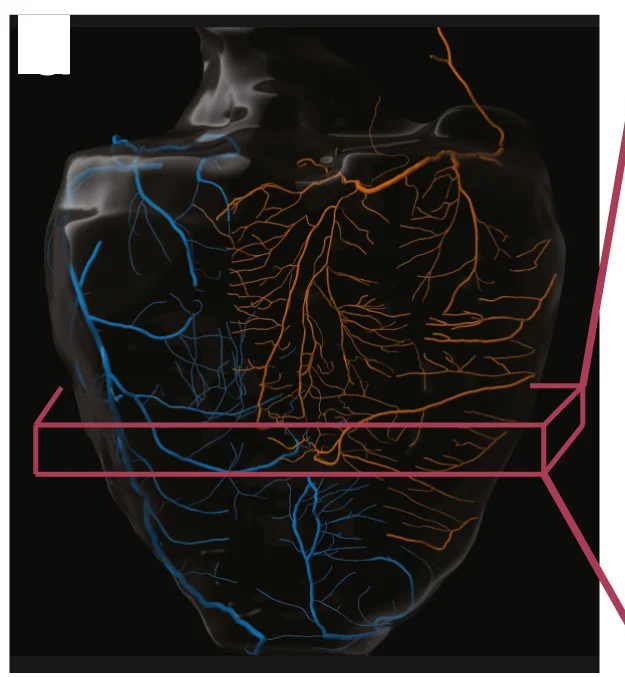 Open access visualization of 3D Plot, Artery Tracings, Artery Branches, Coronary Arteries, Co-dominance