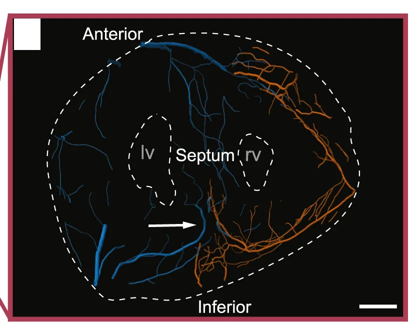 Open access visualization of Network, Pathway, Artery Tracings, Artery Branches, Coronary Arteries