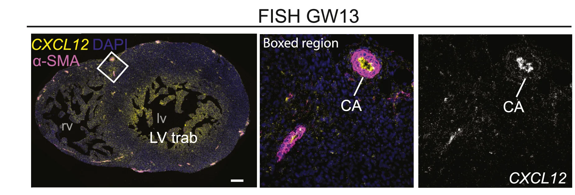 Open access visualization of Microscopy, Fluorescence In Situ Hybridization, Immunolabeling, Heart, Coronary Arteries
