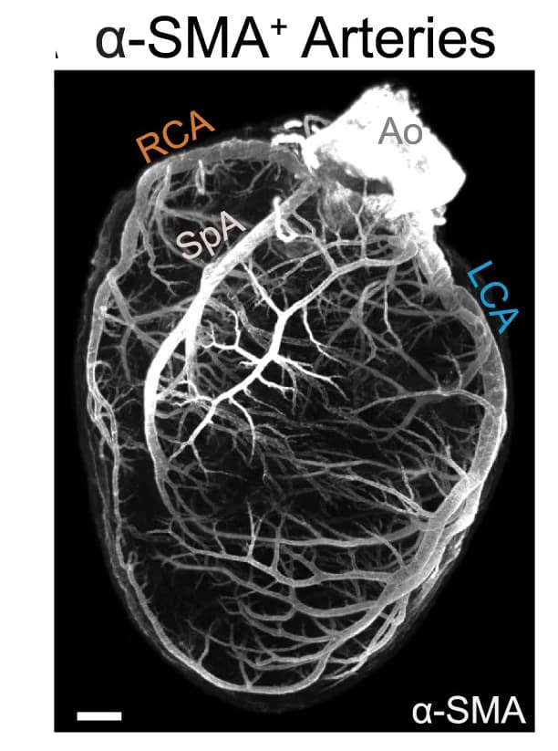 Open access visualization of Microscopy, Immunolabeling, Coronary Artery, Smooth Muscle, Mouse Heart