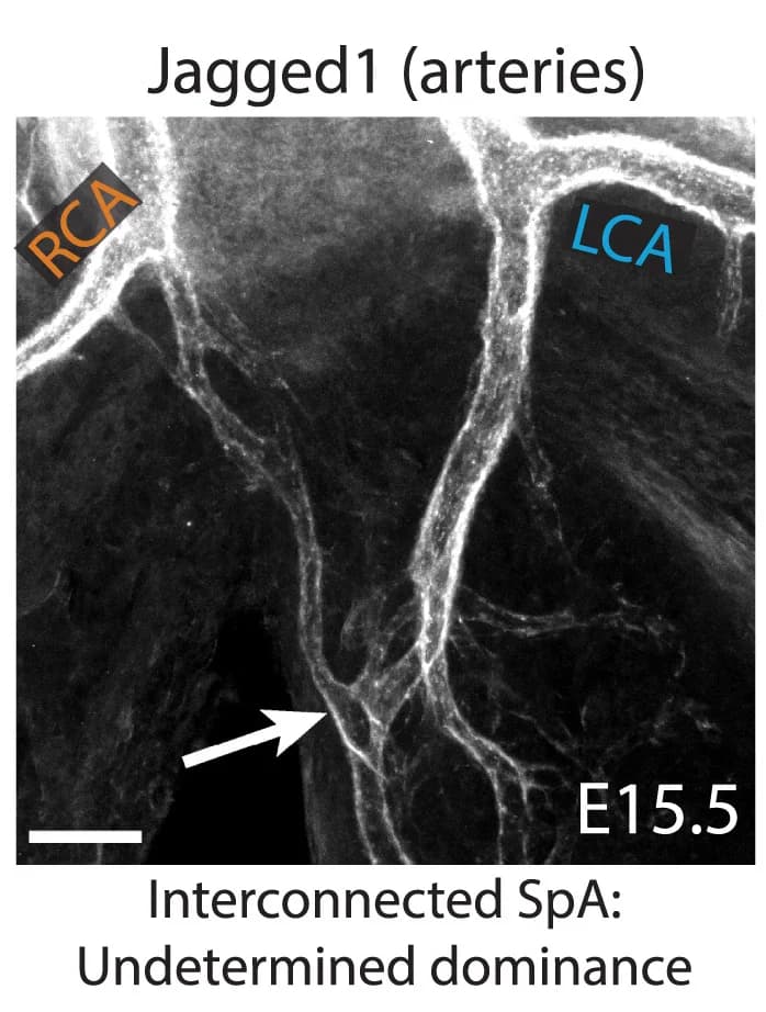 Open access visualization of Microscopy, Immunolabeling, Embryonic Hearts, Artery Network, SpA