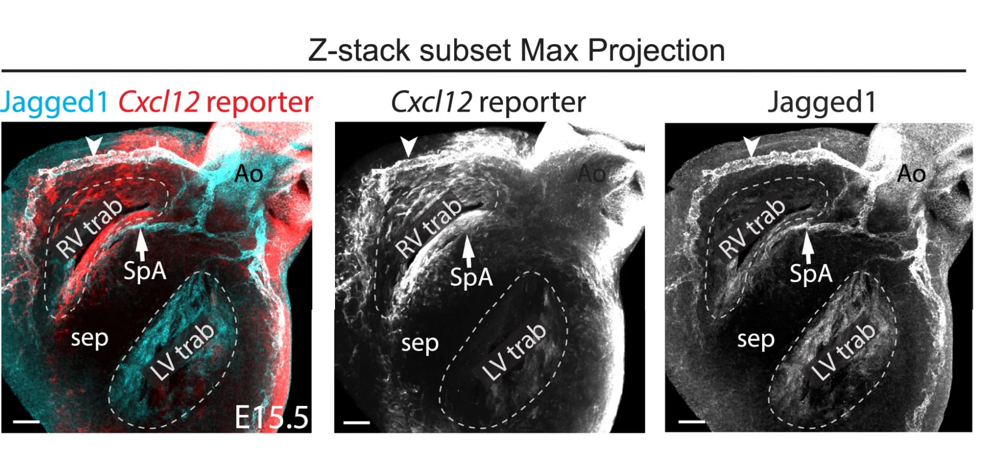 Open access visualization of Microscopy, Cxcl12 Reporter, SpA, Artery ECs