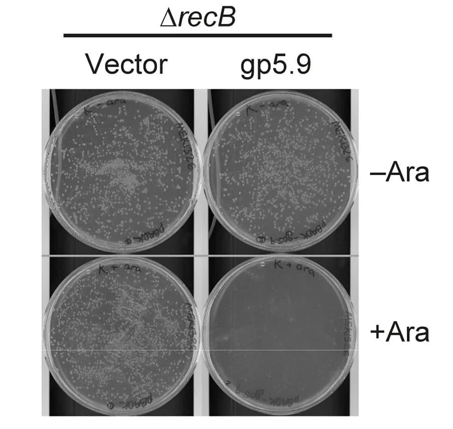 Open access visualization of Photo, Gel, E. Coli, Transformation, Kanamycin