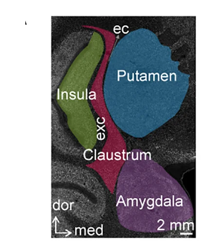 Open access visualization of Microscopy, Claustrum, Brain Regions, Coronal Section, External Capsule