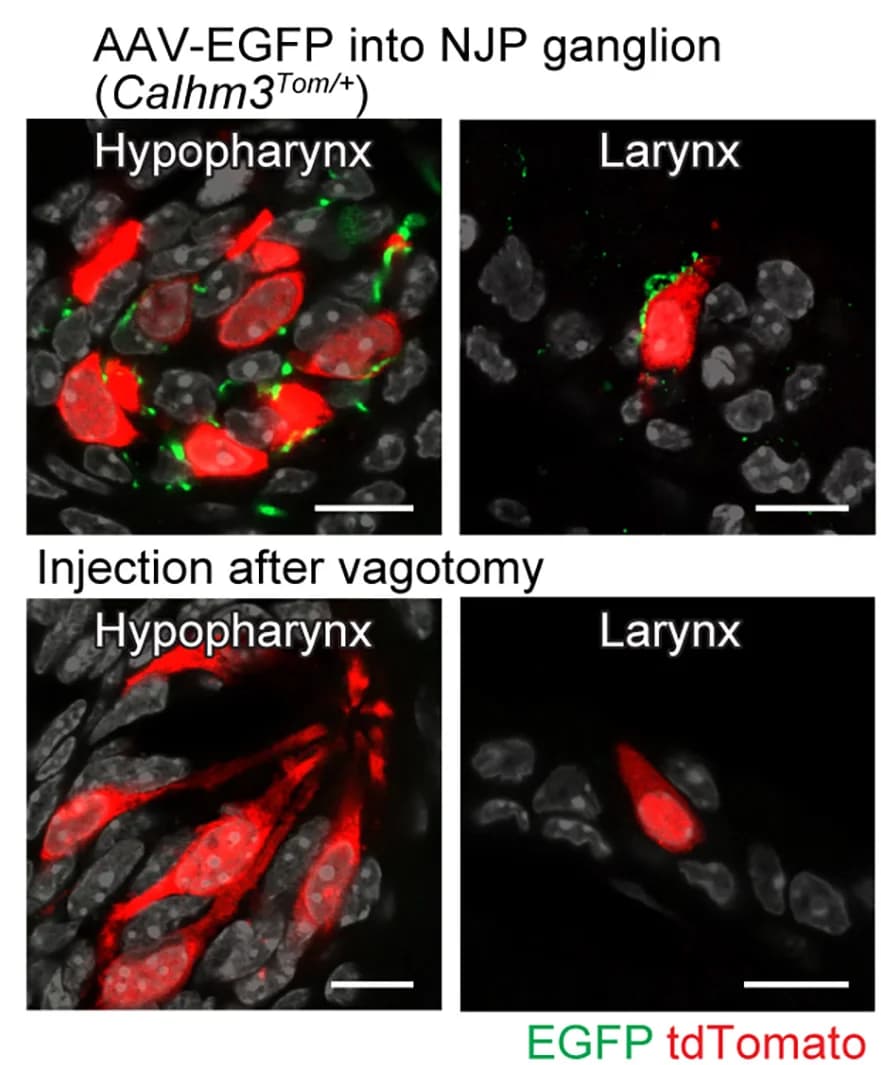 Open access visualization of Microscopy, EGFP, tdTomato, Immunoreactivity, Calhm3Tom/+ mice