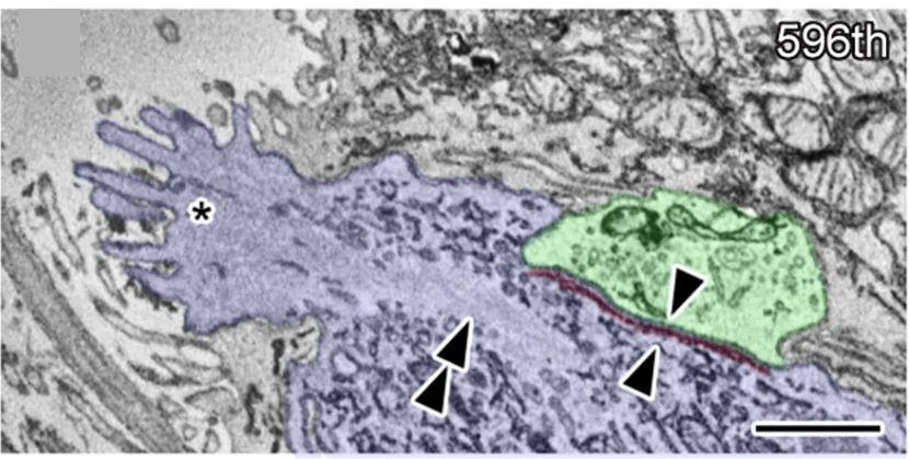 Open access visualization of Microscopy, 3D-CLEM Images, Calhm3+ Taste Cell, Calhm3+ Tuft Cell, SBF-SEM Images