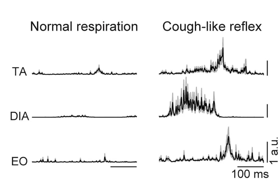 Open access visualization of Line Plot, EMG Power, Normal Respiration, Cough-like Reflex