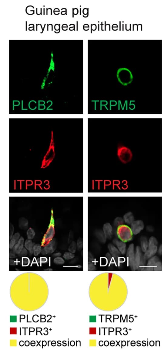 Open access visualization of Microscopy, Pie Chart, Immunofluorescence, PCC Marker Proteins, Laryngeal Epithelium