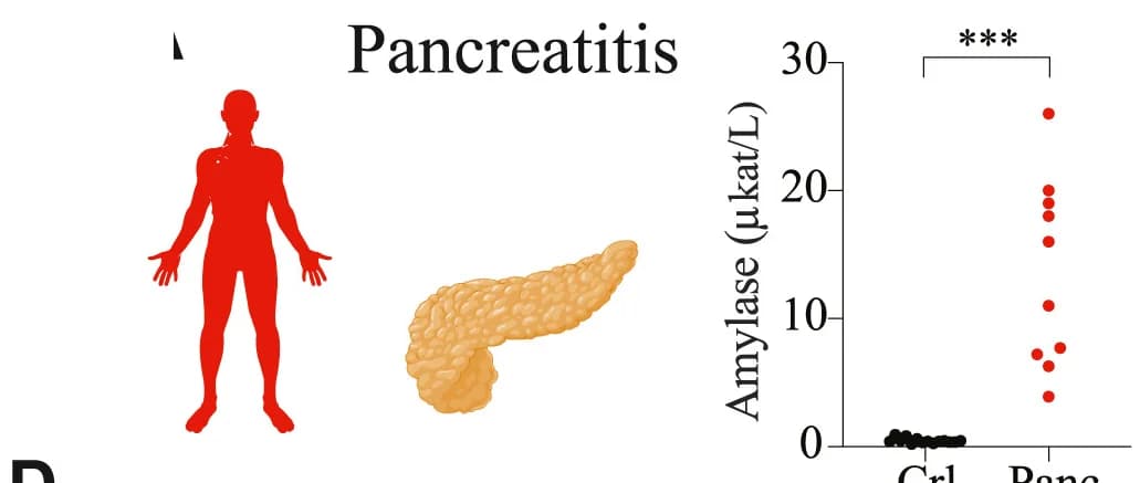 Open access visualization of Scatter Plot, Illustration, Pancreatitis, Myocardial Infarction, Infection