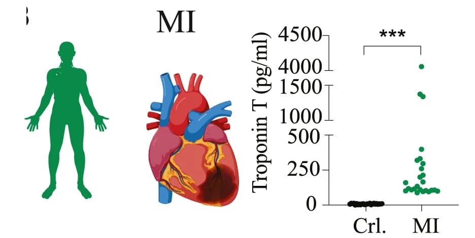 Open access visualization of Scatter Plot, Pancreatitis, Myocardial Infarction, Infection, Biomarkers