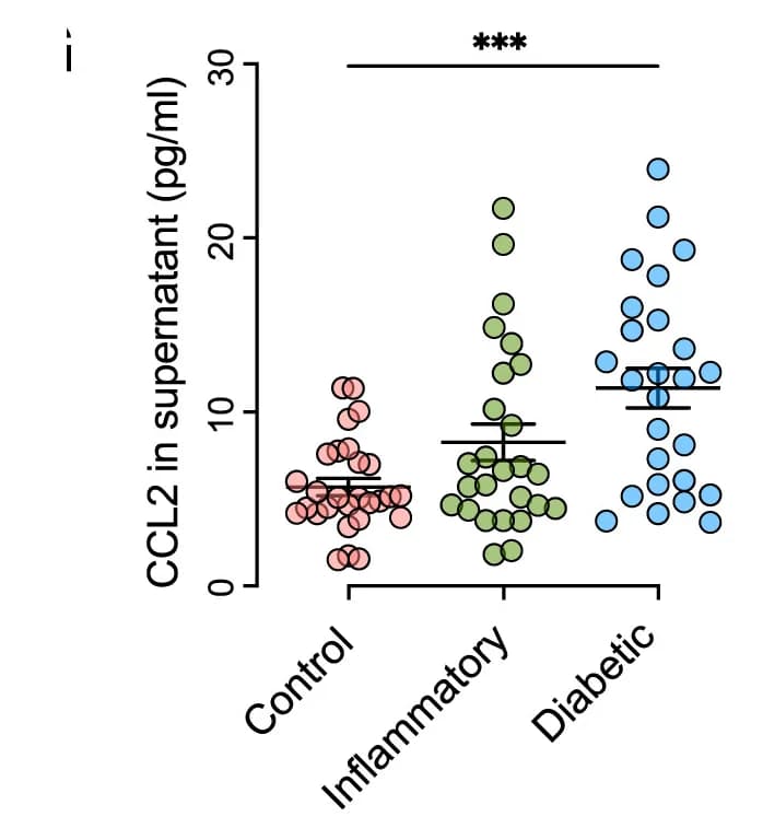 Open access visualization of Scatter Plot, Error Bars, CCL2 Concentration, BVO Supernatant, ELISA
