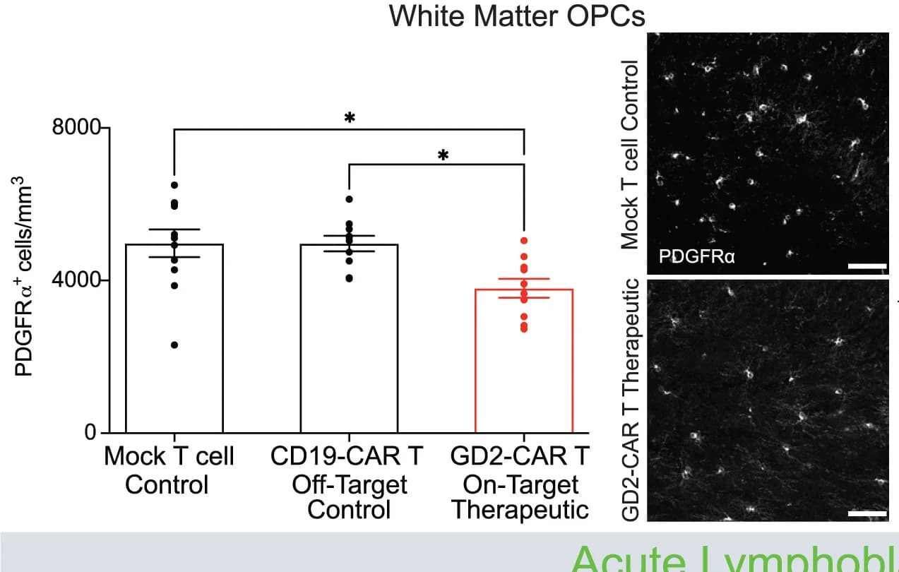 Open access visualization of Bar Plot, Scatter Plot, Microscopy, PDGFRa+OPCs, Corpus Callosum