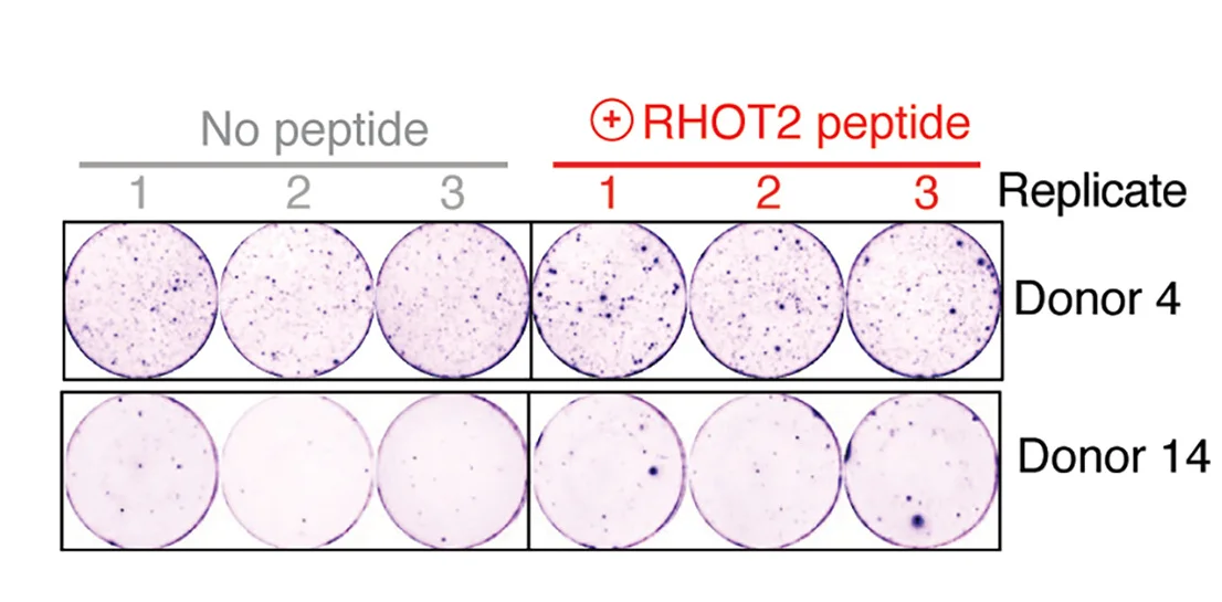Open access visualization of Microscopy, IFN-γ ELISpot Images, PBMCs, RHOT2 Peptide #5, DMSO