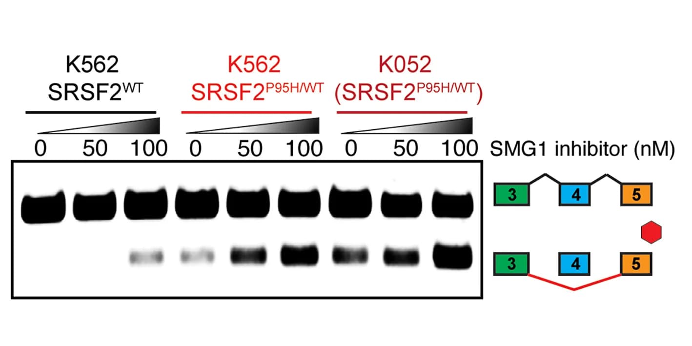Open access visualization of Gel, Illustration, RT-qPCR, CLK3 Exon 4 Skipping, K562 Cells