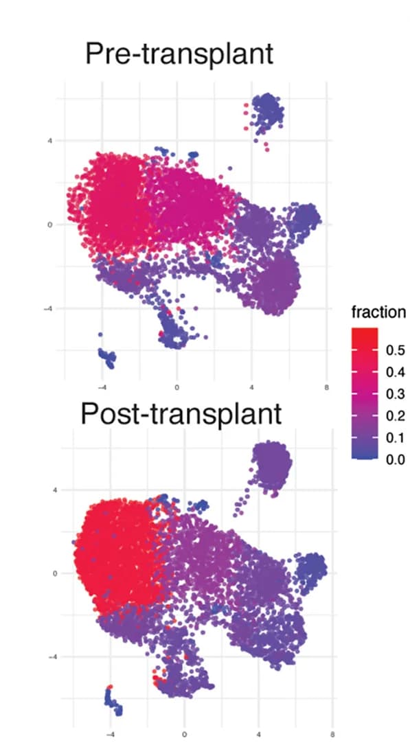 Open access visualization of Scatter Plot, UMAP, Cell Fraction, Cell Cluster, Pre-Transplant