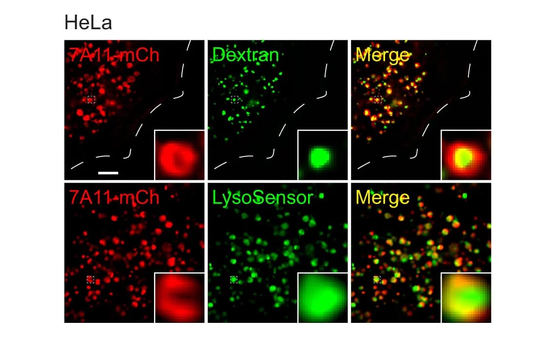Open access visualization of Microscopy, SLC7A11, mCherry, Lysosomal Membrane, HeLa Cells