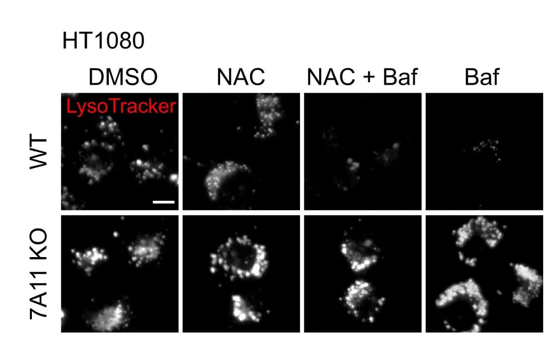 Open access visualization of Microscopy, Lysosomal Acidity, LysoTracker Assay, WT HT1080 Cells, SLC7A11KO HT1080 Cells