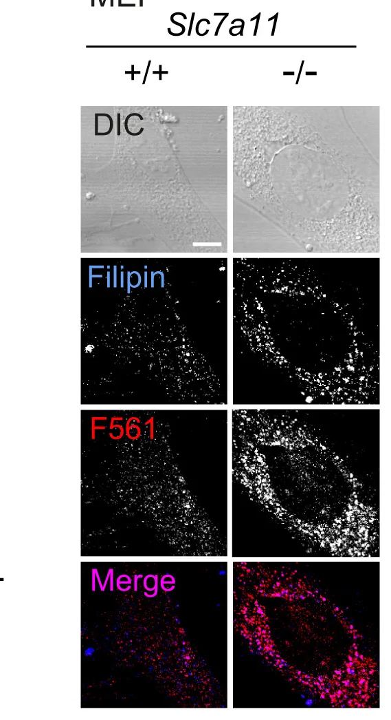Open access visualization of Microscopy, Free Cholesterol, Filipin Assay, Lipofuscin, Autofluorescence Emission