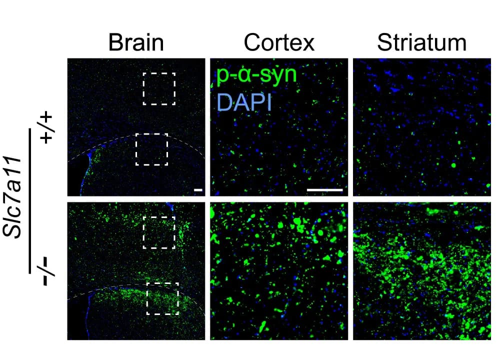 Open access visualization of Microscopy, Phosphorylated α-Synuclein, Immunofluorescence, Brain Sections, Littermate Pairs