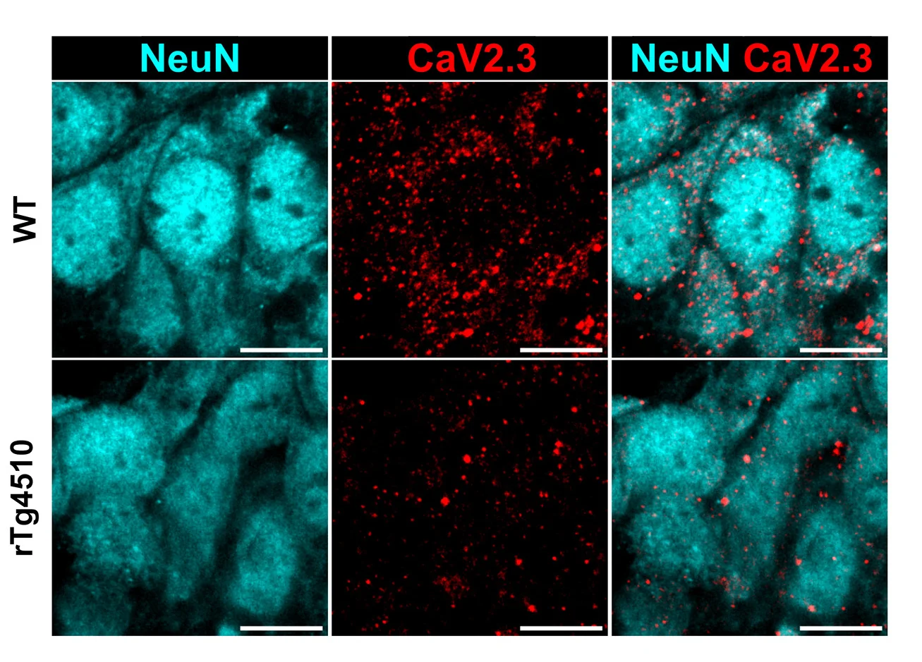 Open access visualization of Microscopy, Immunofluorescent Images, NeuN, CaV2.3, Pyramidal Layer
