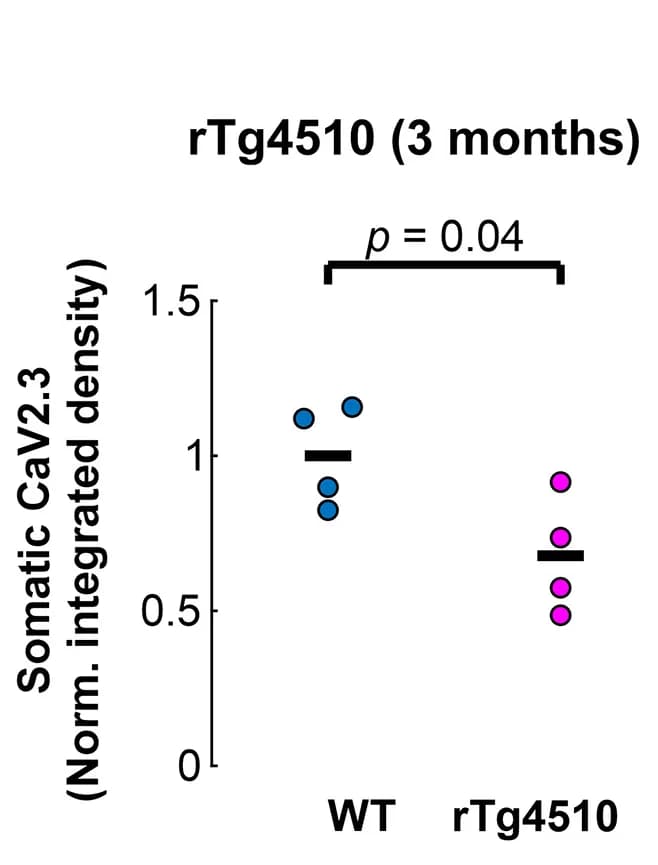 Open access visualization of Scatter Plot, Integrated Density, Somatic CaV2.3 Staining, Soma Area, WT Mouse