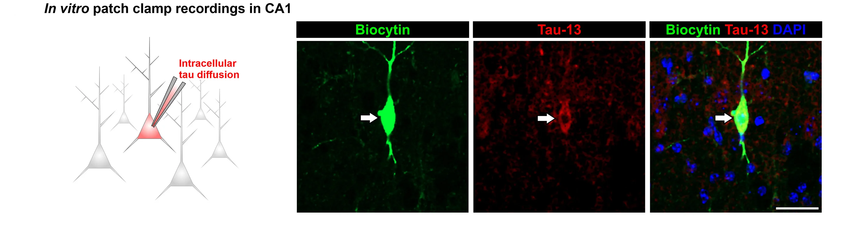 Open access visualization of Microscopy, Illustration, Hippocampal Slice, Patch-Clamp Recordings, CA1 Pyramidal Neurons