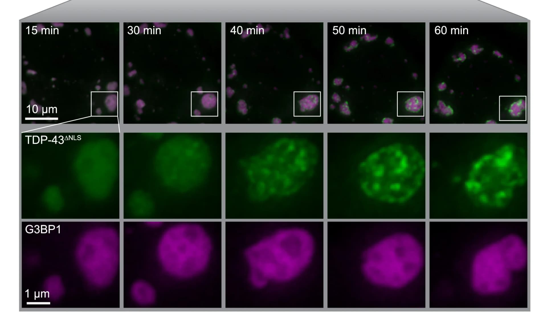 Open access visualization of Microscopy, Time-Lapse Analysis, TDP-43deltaNLS, Stress Granule, Confocal Images