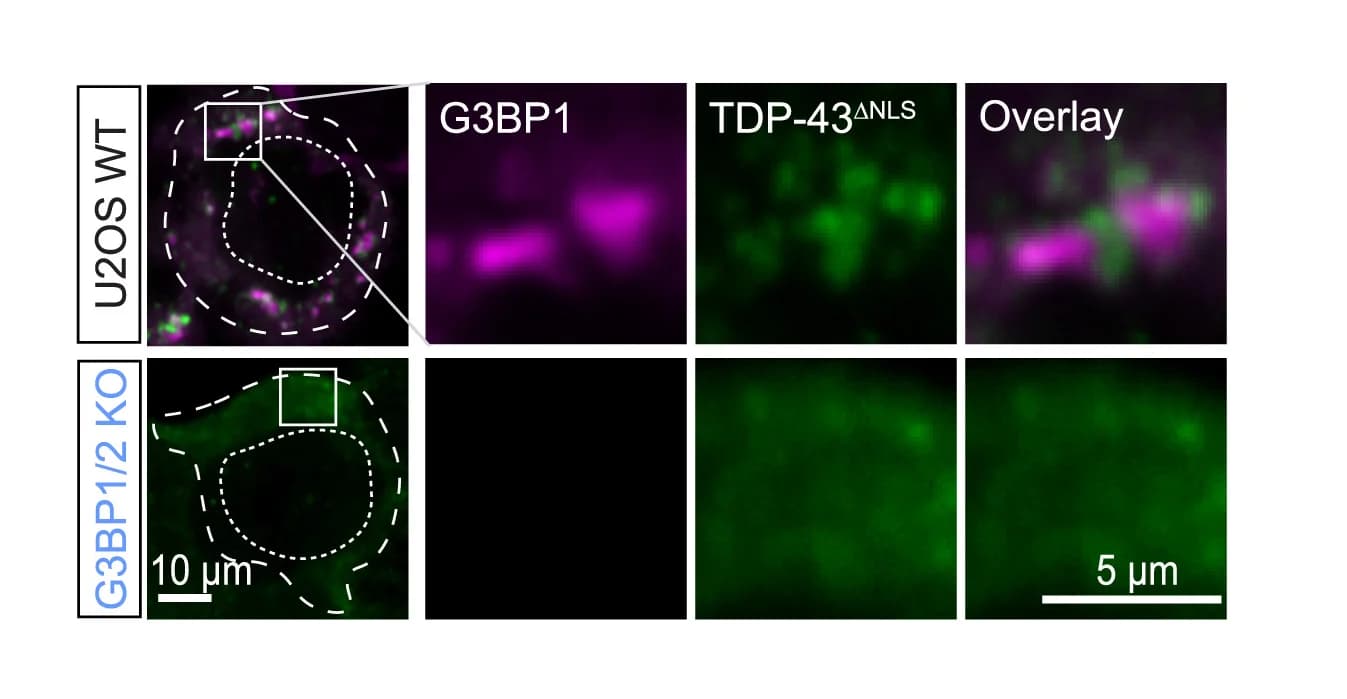 Open access visualization of Microscopy, TDP-43 Aggregation, Stress Granules, G3BP1/2 KO U2OS Cells, TDP-43deltaNLS