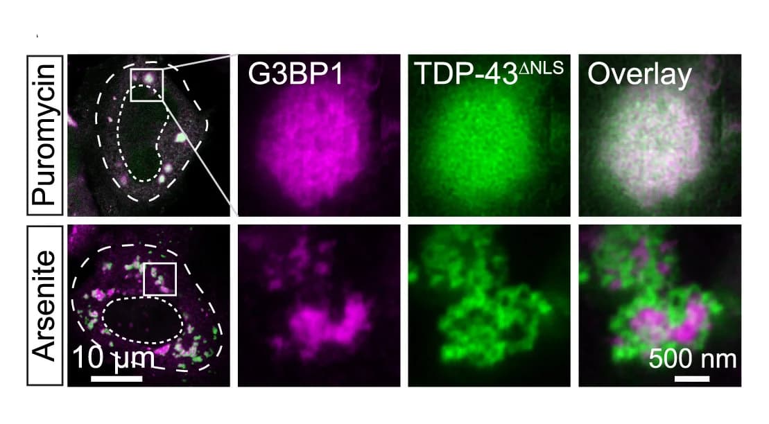 Open access visualization of Microscopy, Oxidization, TDP-43, STED, HeLa Cells