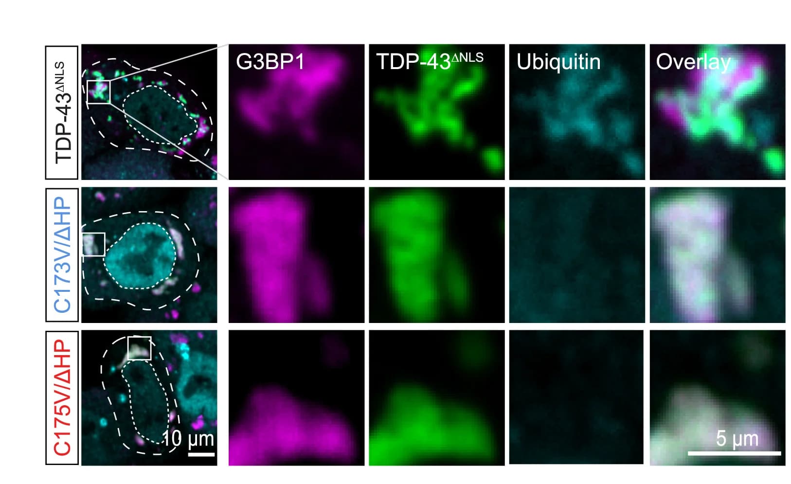 Open access visualization of Microscopy, Intra-condensate Demixing, TDP-43, Pathological Aggregates, TDP-43ΔNLS variants