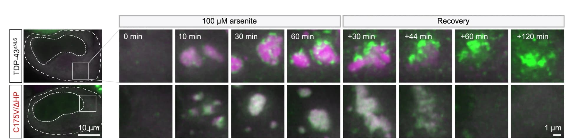 Open access visualization of Microscopy, Photo, Live Imaging, Cells, TDP-43ΔNLS variants