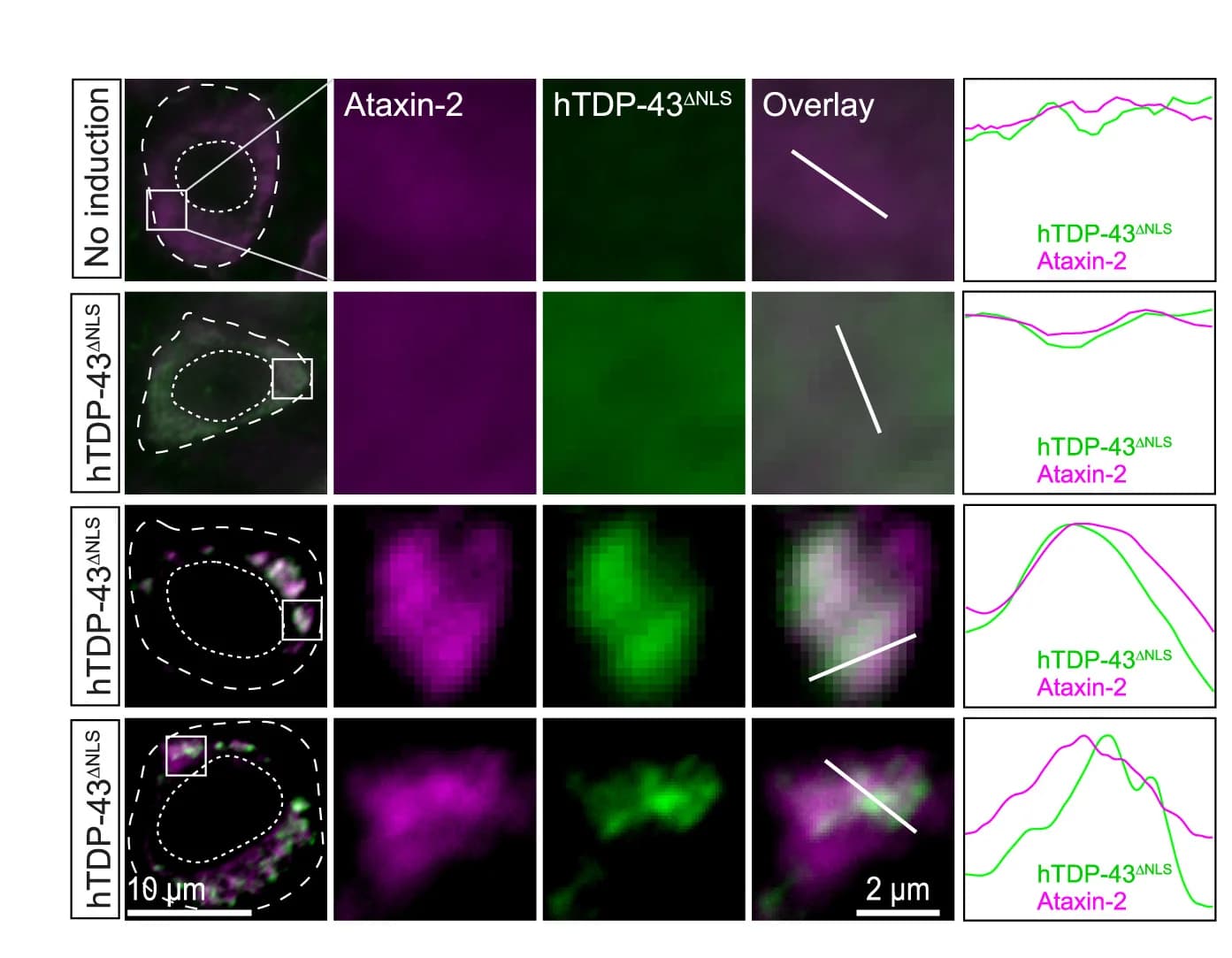 Open access visualization of Microscopy, Line Plot, Hippocampal Neurons, rNLS8 Mice, hTDP-43ΔNLS Induction