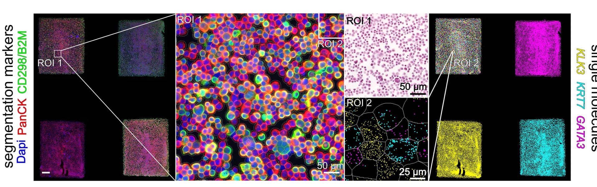 Open access visualization of Microscopy, Immunofluorescence, DAPI Staining, CD298/B2M, Pan-cytokeratin